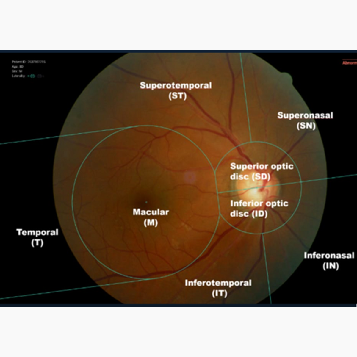 Produktfoto VUNO-Fundus-AI-Macular