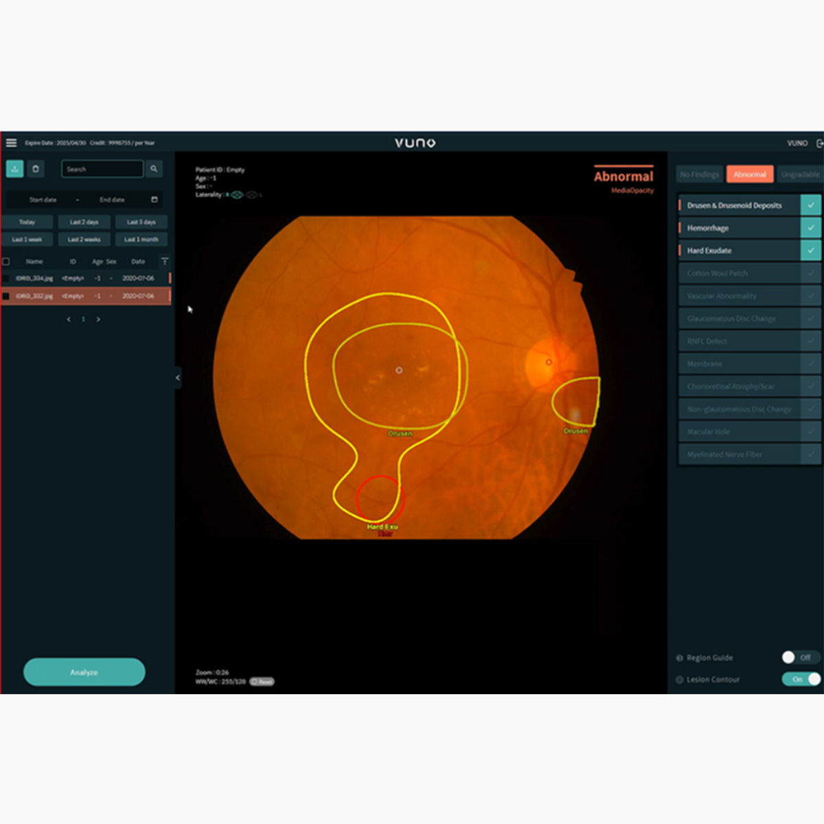 Produktfoto VUNO-Fundus-AI