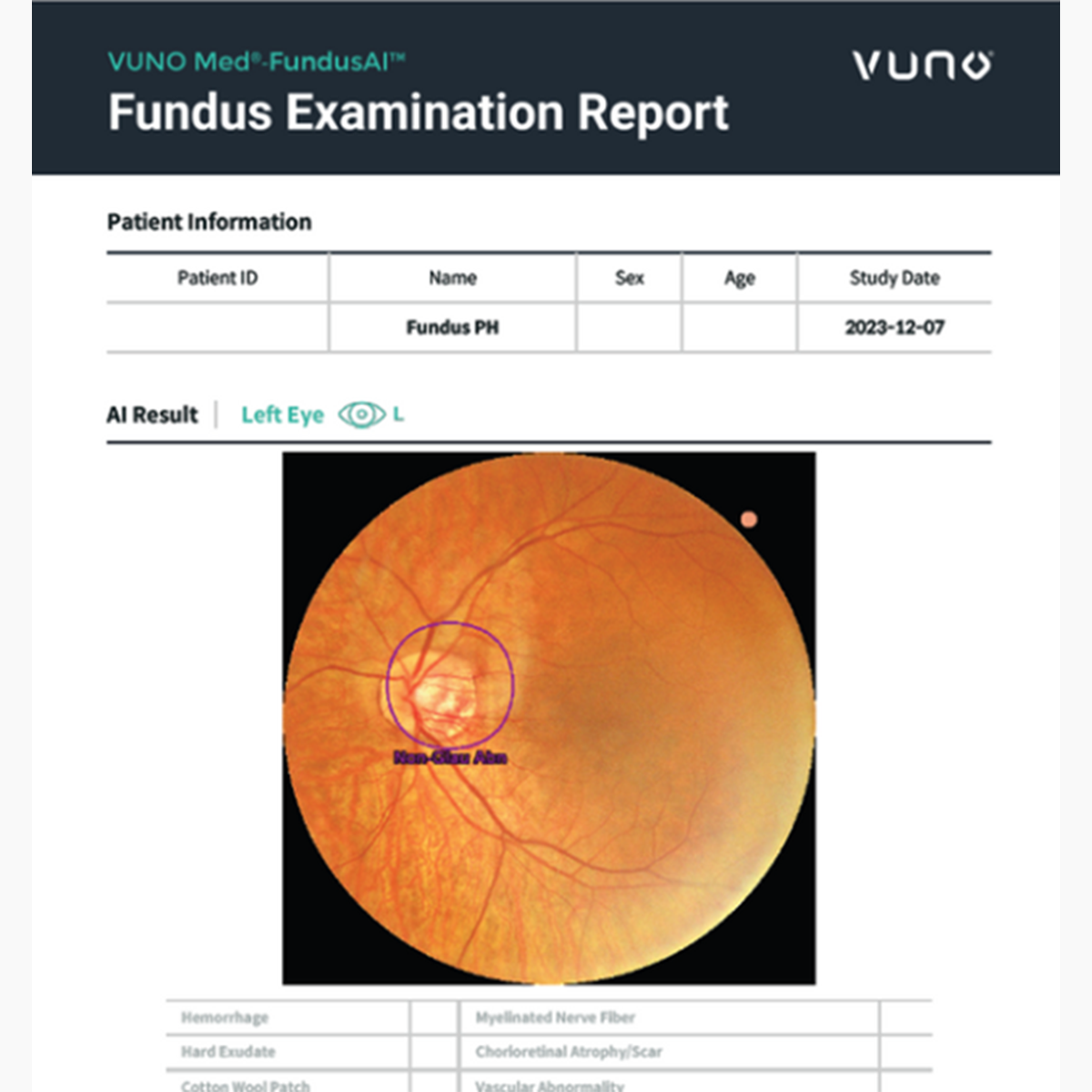Produktfoto Vuno-Fondus-Examination-Report