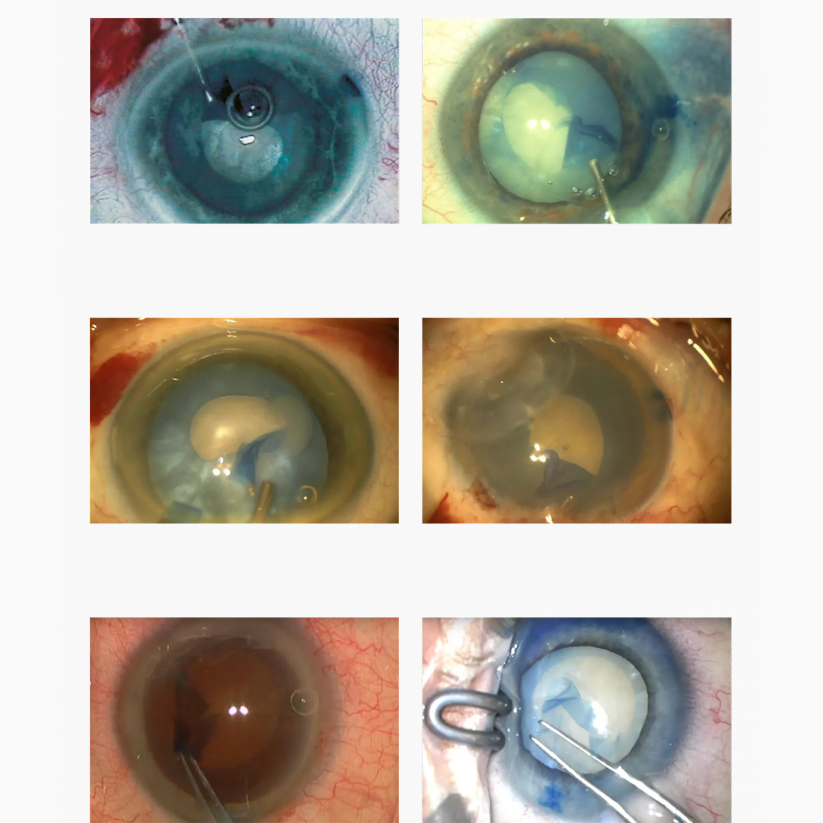 Produktfoto DORC-See-the-difference_VisionBlue